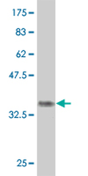 DEPDC1 monoclonal antibody (M05), clone 6H1