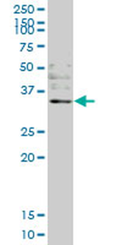 OTUB1 monoclonal antibody (M09), clone 1C12