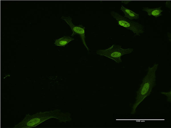 BATF3 monoclonal antibody (M04), clone 3H1