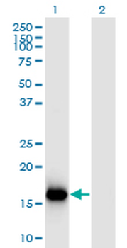 BATF3 monoclonal antibody (M04), clone 3H1