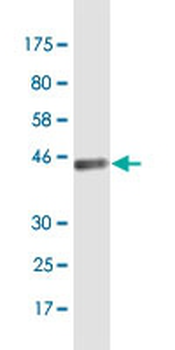 BATF3 monoclonal antibody (M04), clone 3H1