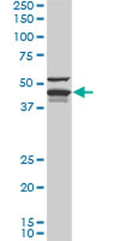 DNAJA4 monoclonal antibody (M01), clone 4B4-1F2