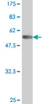 ABHD10 polyclonal antibody (A01)