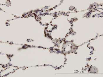 FBXW7 monoclonal antibody (M02), clone 3D1