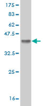 FBXW7 monoclonal antibody (M02), clone 3D1