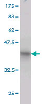 RHOT1 monoclonal antibody (M01), clone 4H4