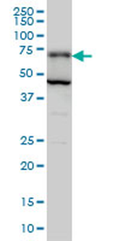 PGM2 monoclonal antibody (M05), clone 1A3