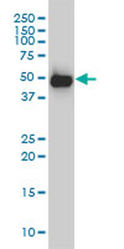 SMU1 monoclonal antibody (M01), clone 2B12-2F2