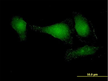 APPL2 purified MaxPab mouse polyclonal antibody (B01P)