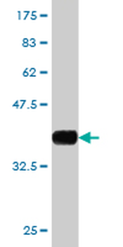 WIPI1 monoclonal antibody (M02), clone 3C1