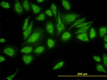 USP47 monoclonal antibody (M01), clone 5F9