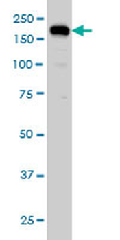 USP47 monoclonal antibody (M01), clone 5F9