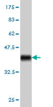 USP47 monoclonal antibody (M01), clone 5F9