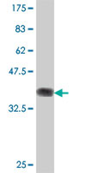 PINX1 polyclonal antibody (A01)