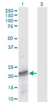 ODAM monoclonal antibody (M02), clone 2F8