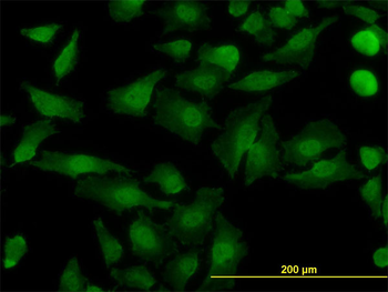 NDE1 monoclonal antibody (M01), clone 2G11-1C11
