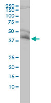 NDE1 monoclonal antibody (M01), clone 2G11-1C11