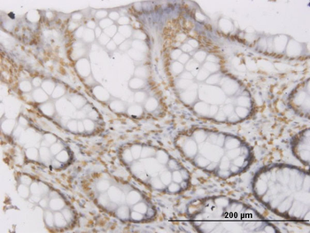 ROPN1 monoclonal antibody (M03), clone 4E11