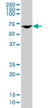 DDX56 monoclonal antibody (M03), clone 6B9
