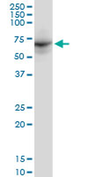 DDX56 monoclonal antibody (M03), clone 6B9
