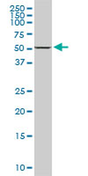DDX56 monoclonal antibody (M03), clone 6B9