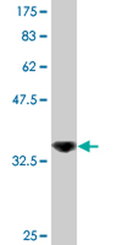 DDX56 monoclonal antibody (M03), clone 6B9
