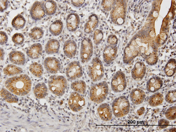 UGT1A9 purified MaxPab mouse polyclonal antibody (B01P)