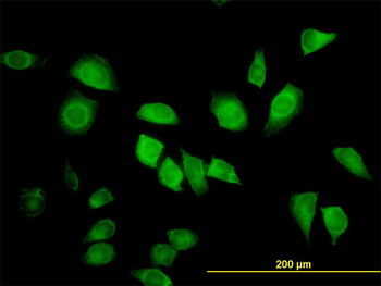 LZTFL1 monoclonal antibody (M01), clone 7F6