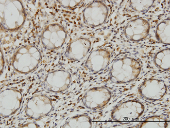 LZTFL1 monoclonal antibody (M01), clone 7F6