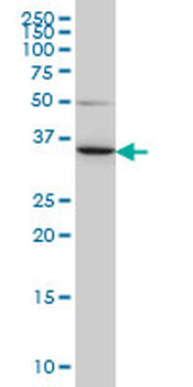 LZTFL1 monoclonal antibody (M01), clone 7F6