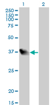 LZTFL1 monoclonal antibody (M01), clone 7F6