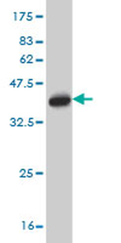 LZTFL1 monoclonal antibody (M01), clone 7F6