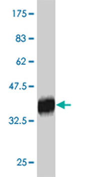 RNF186 monoclonal antibody (M01), clone 4F10