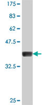 GDAP1 polyclonal antibody (A01)