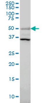 ERRFI1 monoclonal antibody (M01), clone 2B9