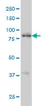RIPK4 monoclonal antibody (M01), clone 2G3