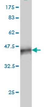 RIPK4 monoclonal antibody (M01), clone 2G3