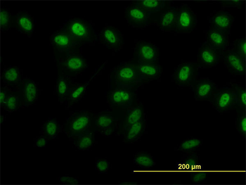 SIX4 monoclonal antibody (M07), clone 5E1