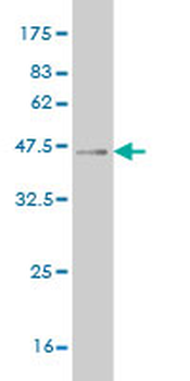SIX4 monoclonal antibody (M07), clone 5E1