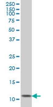GHRL monoclonal antibody (M01), clone 2F4