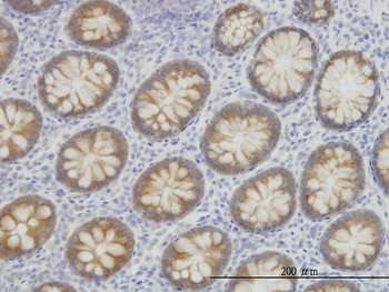 ACSL5 monoclonal antibody (M01), clone 5H8