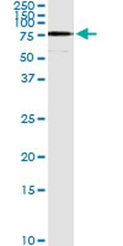 ACSL5 monoclonal antibody (M01), clone 5H8