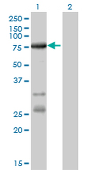 ACSL5 monoclonal antibody (M01), clone 5H8