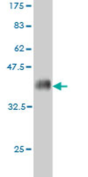 ACSL5 monoclonal antibody (M01), clone 5H8