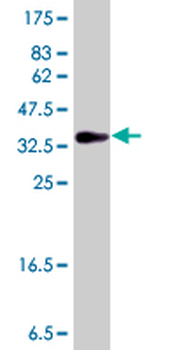 HECA polyclonal antibody (A01)