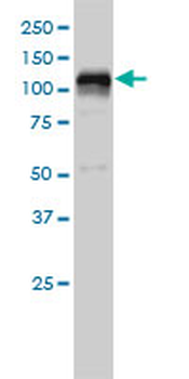 HDAC7A monoclonal antibody (M01), clone 2B11-1C1
