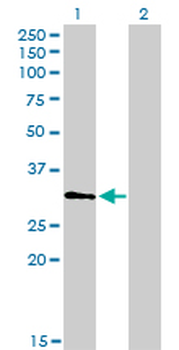 HDAC7A monoclonal antibody (M01), clone 2B11-1C1