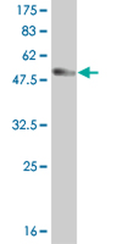 HDAC7A monoclonal antibody (M01), clone 2B11-1C1