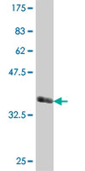 SCLY polyclonal antibody (A01)