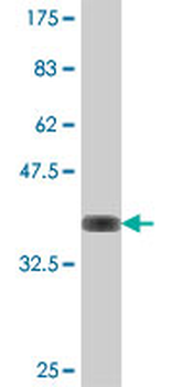 ISYNA1 polyclonal antibody (A01)